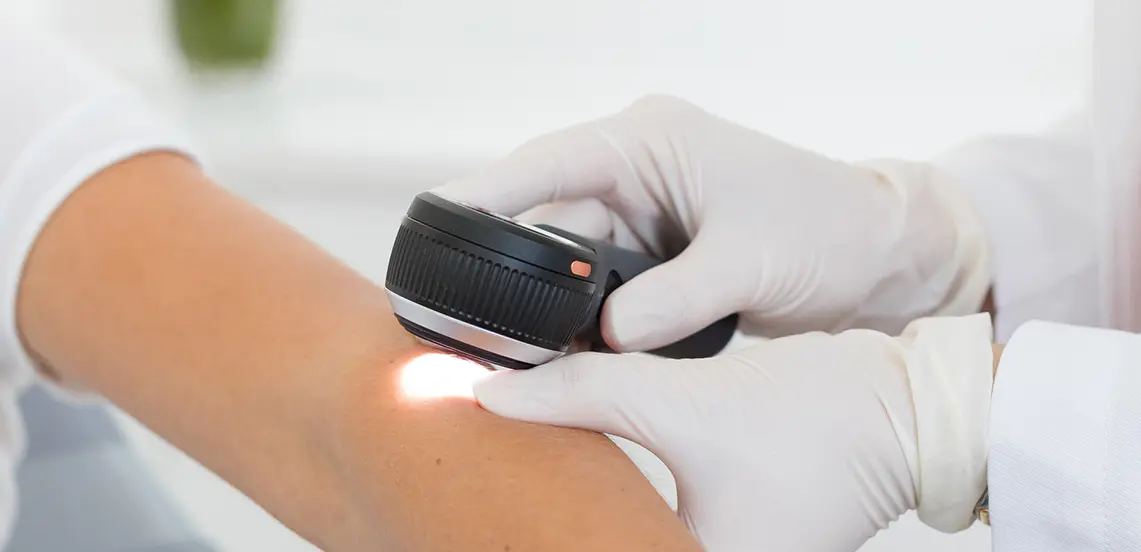 Skin Cancer Screening and Detection in Greenwich, CT