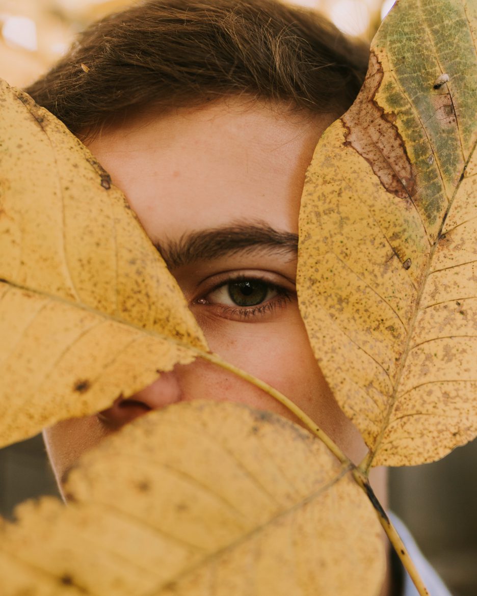 The Mask of Melasma