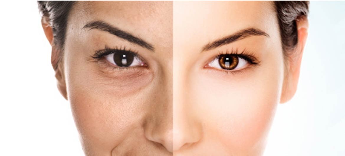 How Permea Laser Let the Good Stuff In Your Skin