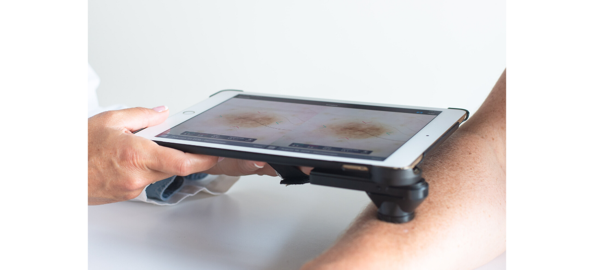 Total Body Photography Could Save Your Life